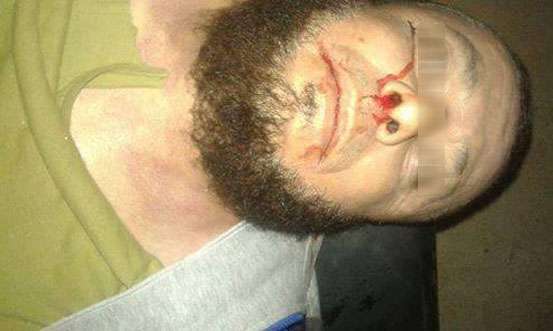 В провинции Идлиб убит полевой командир так называемой сирийской свободной армии